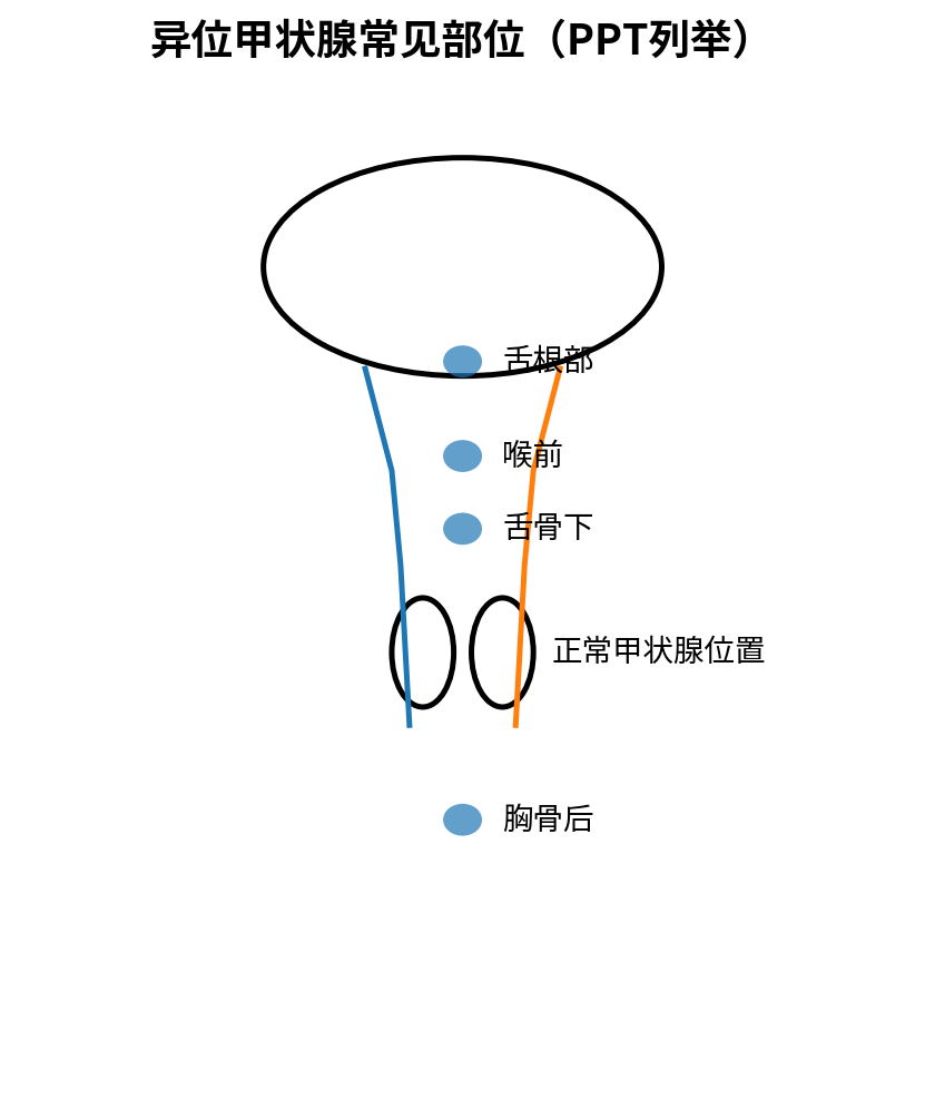 图：异位甲状腺常见位置示意