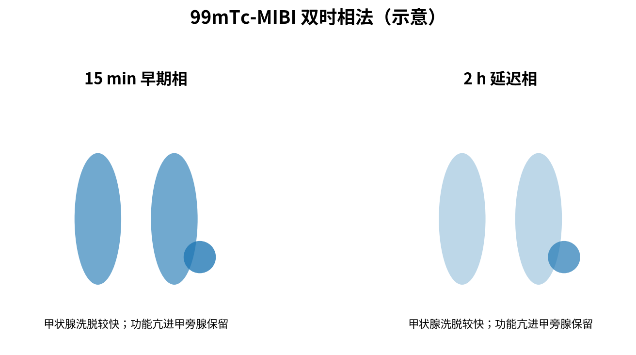 图：MIBI双时相法——延迟相甲状旁腺病灶相对保留