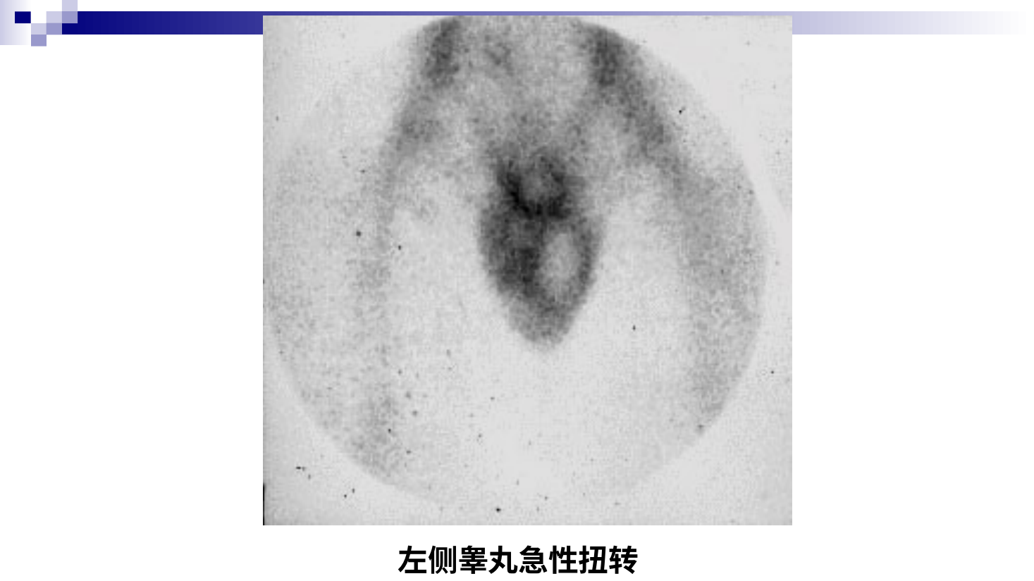 图11