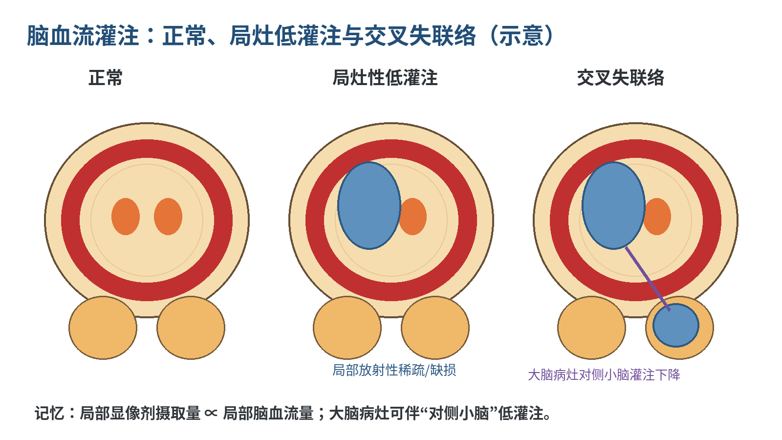 图2  脑血流灌注常见判断思路（示意图，根据PPT考点重绘）