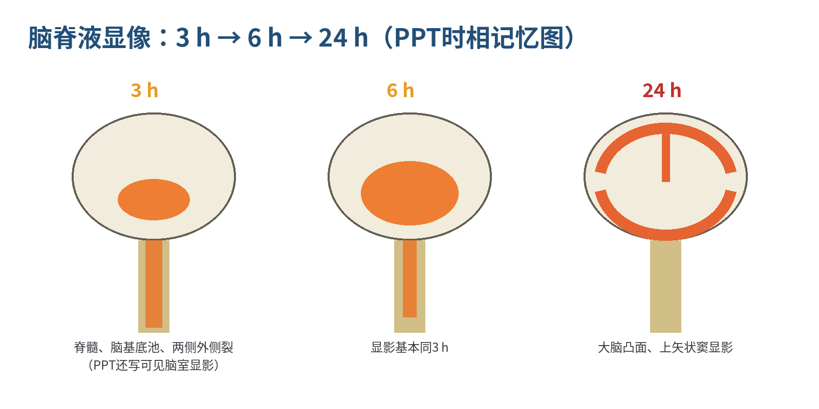 图5  脑脊液显像的3/6/24 h时相记忆（根据PPT文字重绘）